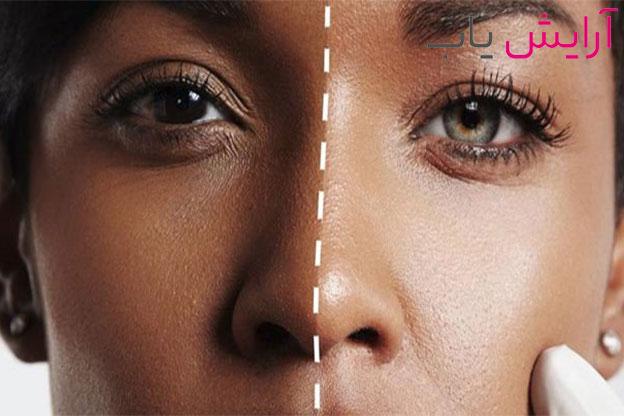 سفید شدن پوست صورت سبزه