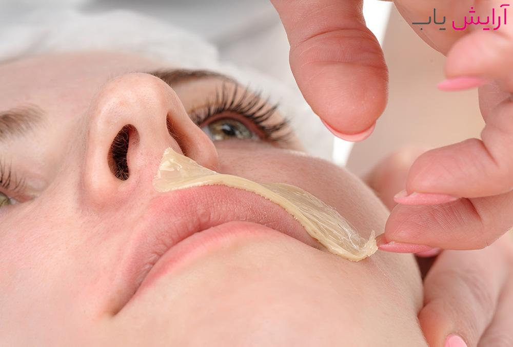 رفع موهای زاید