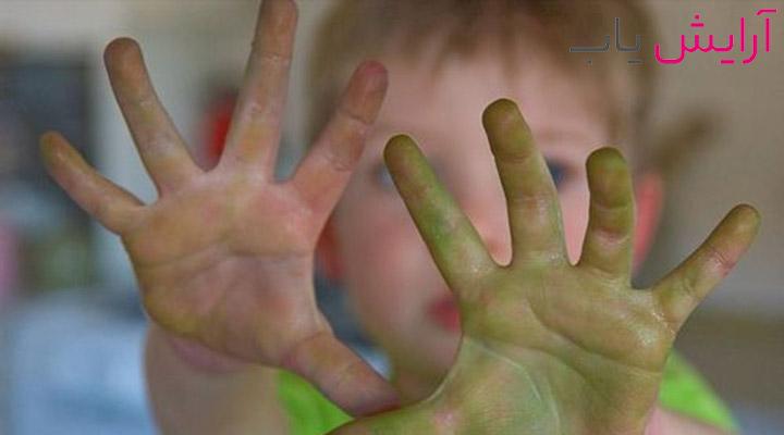 ژل ضدعفونی کننده دست