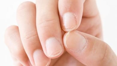 رسیدگی به ناخن های آسیب دیده