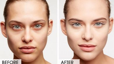 رفع سیاهی دور چشم