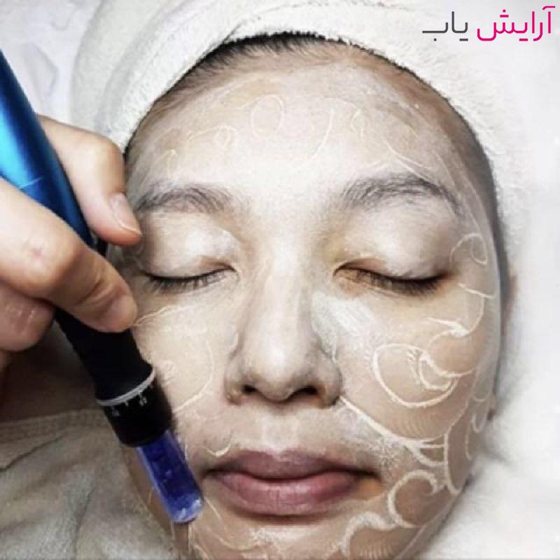 مراحل انجام مزووایت