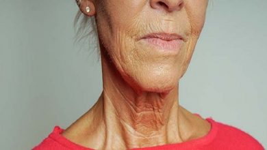 درمان پیری پوست گردن