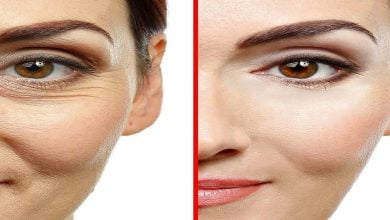 بوتاکس طبیعی در خانه