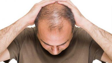 جلوگیری از ریزش مو