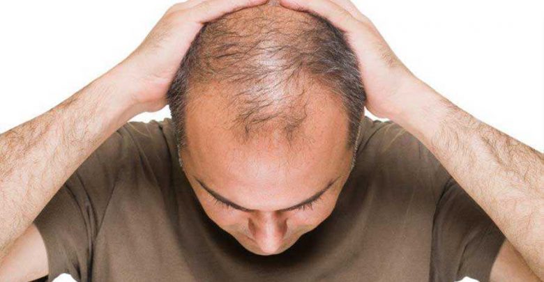 جلوگیری از ریزش مو