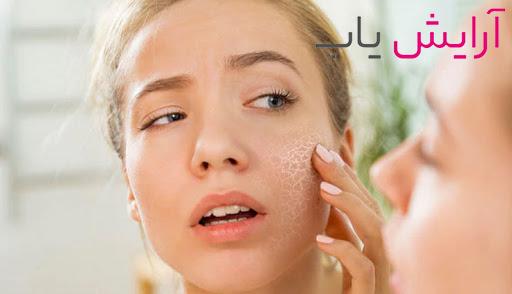 کم آبی پوست